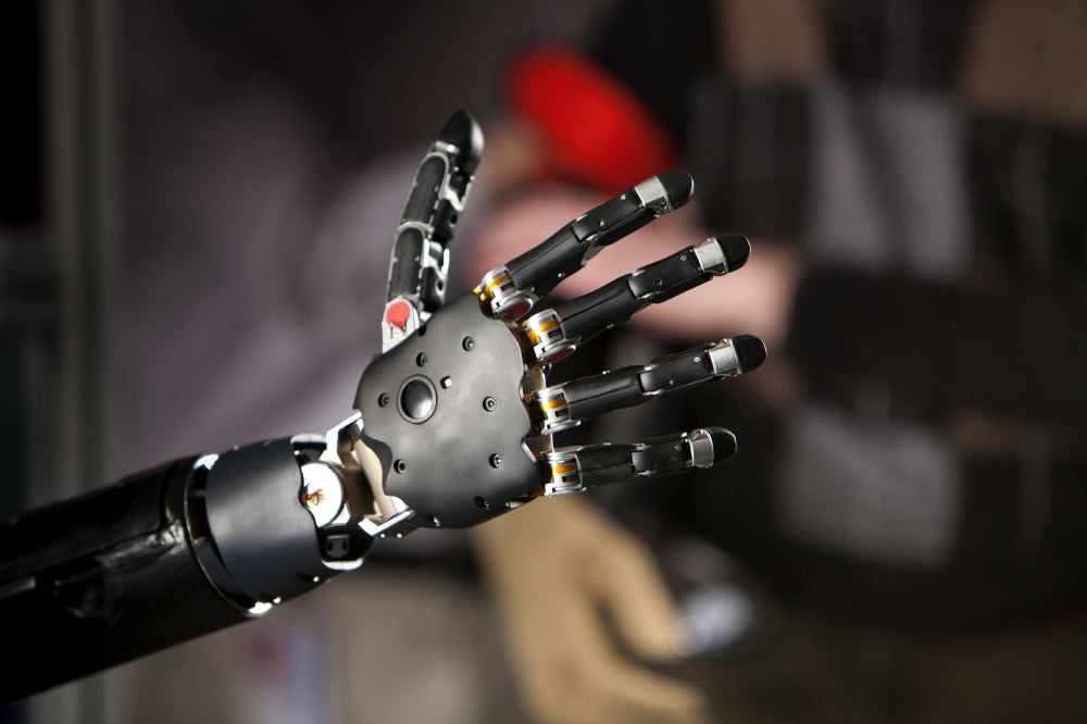 Prosthetic arm