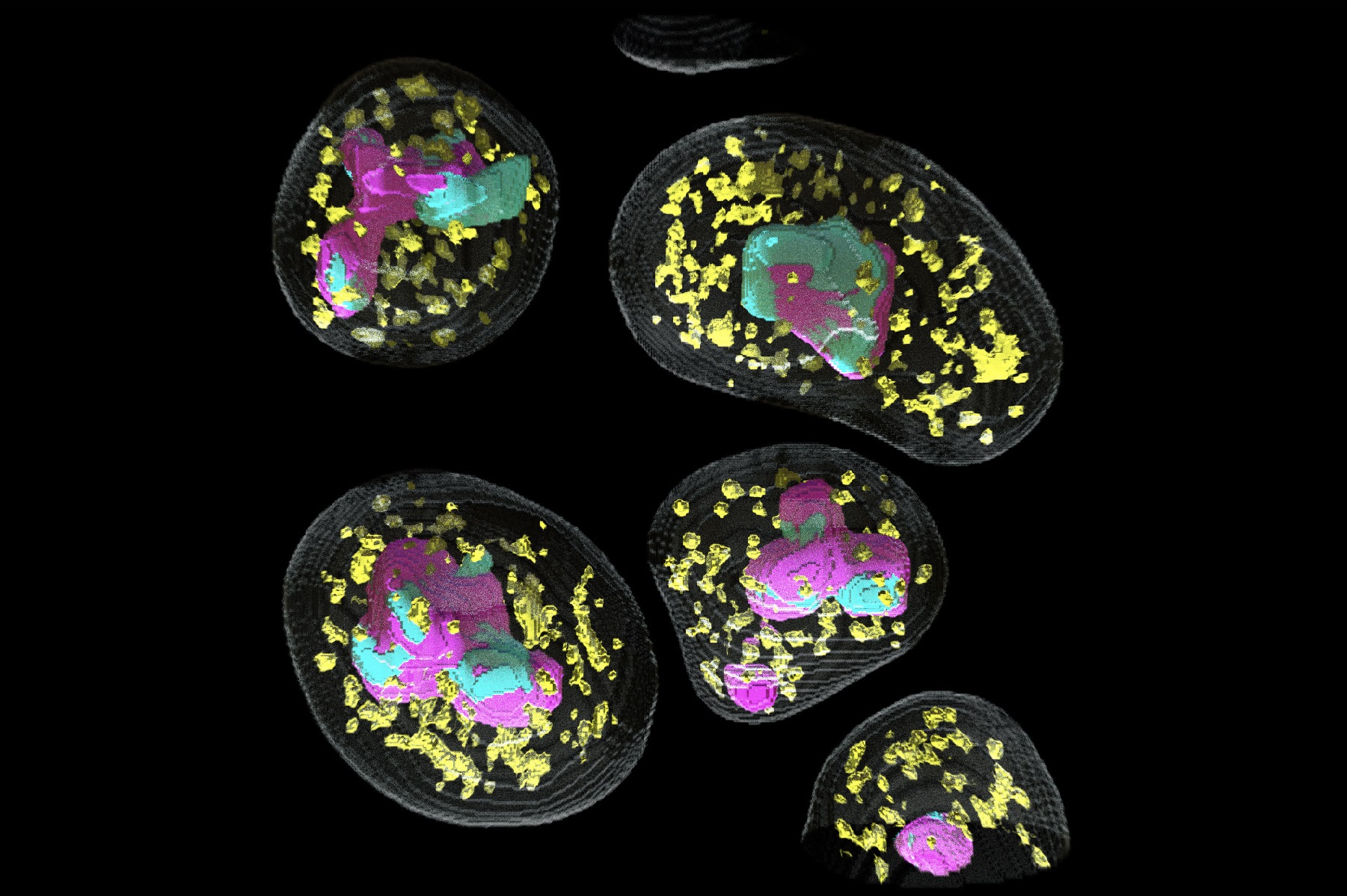Human Stem Cell Nucleus